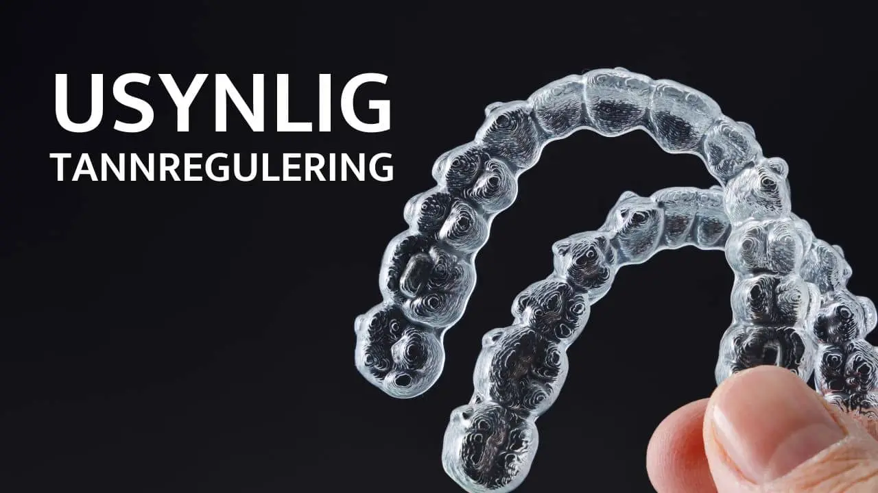 Usynlig tannregulering