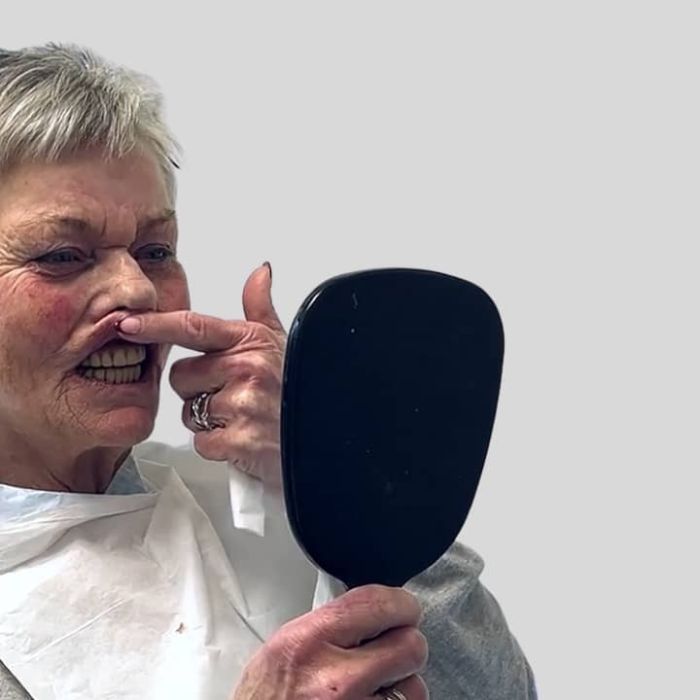 Unni fikk faste tenner på 4 timer