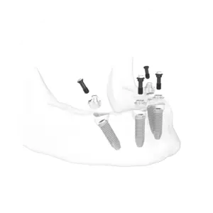 Spesialdesignede skruer brukes for å kune feste bro på implantat.