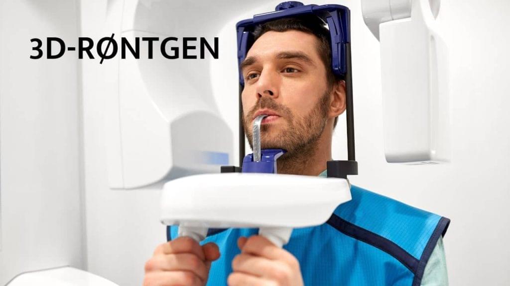 CBCT 3D-røntgen