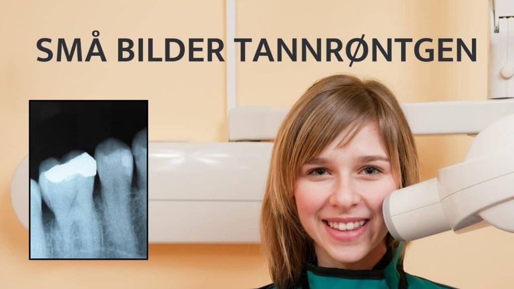 Intraoral røntgenbilder- små røntgenbilder