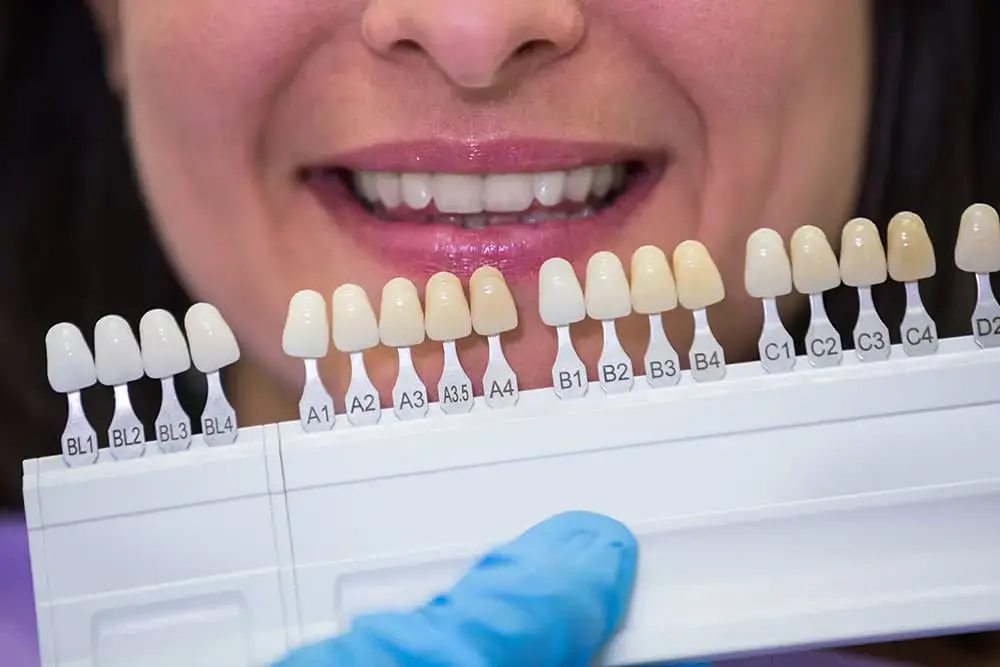 Tannlege og pasient velger farge på tannkroner